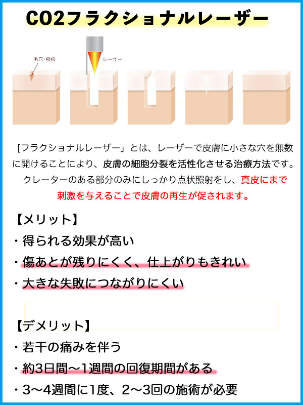 CO2フラクショナルレーザー